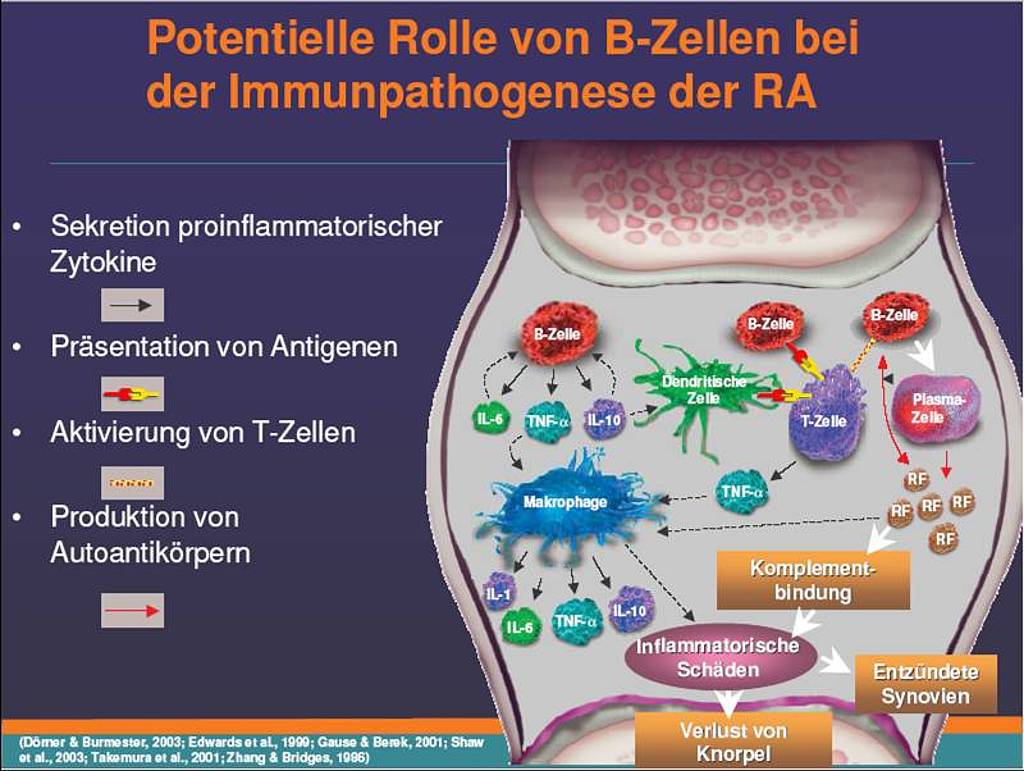 Rituximab: Die B-Zelle Als Therapeutisches Ziel – Rheuma-online