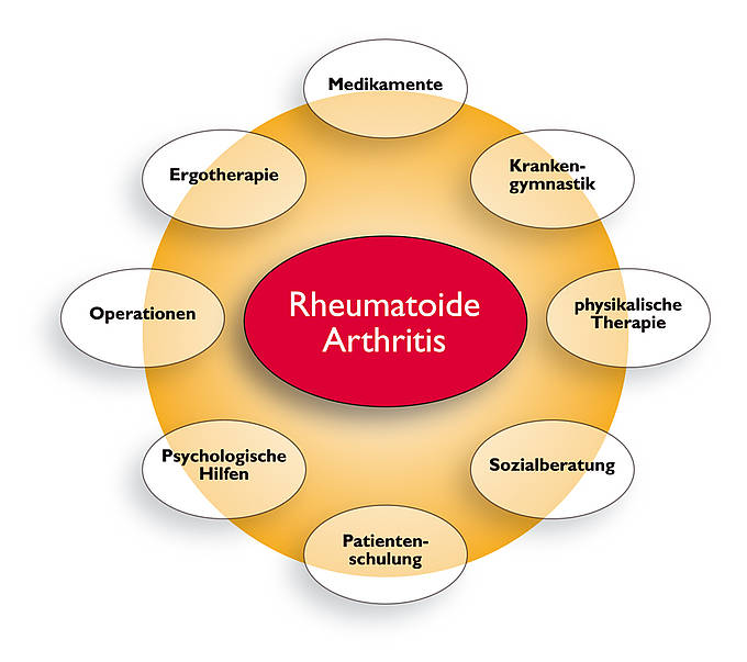 Moderne Rheumatherapie – Rheuma-online